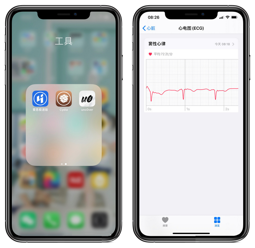 越狱后国行版 Apple Watch 激活 ECG 功能教程